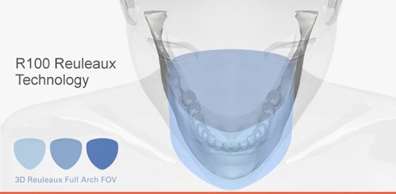 3d snimanje zuba morita